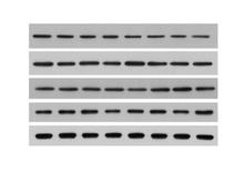 蛋白免疫印迹实验（western blot）