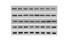 蛋白免疫印迹实验（western blot）