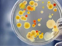微生物污染原因分析