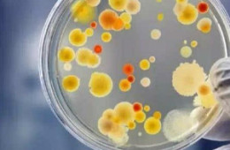 微生物污染原因分析