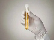 尿液中双酚含量检测