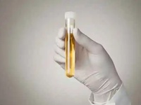 尿液中双酚含量检测