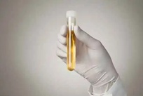 尿液中双酚含量检测