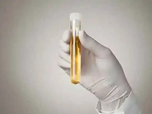 尿液中双酚含量检测