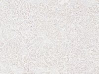 免疫组化病理学检测