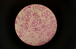 生物毒素检测