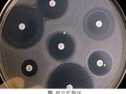 抑菌试验/药敏试验