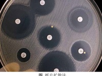 抑菌试验/药敏试验