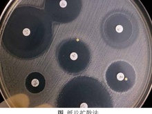 抑菌试验/药敏试验