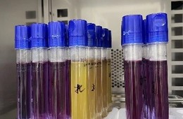 生活饮用水微生物检测