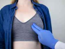 BRCA1/2遗传性乳腺/卵巢癌风险评估