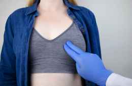 BRCA1/2遗传性乳腺/卵巢癌风险评估