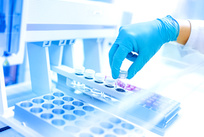 锅炉水理化项目检测