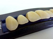 合成树脂牙注册检测